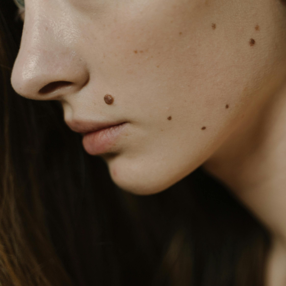Sostenica — piel sensible cuidado facial antiinflamatorio sin conservadores CDMX